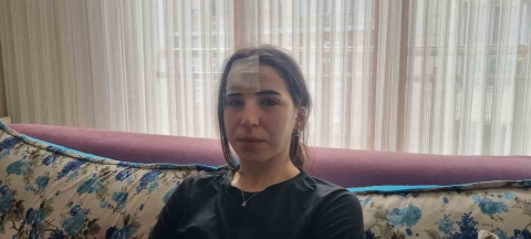 Esenyurt’ta başıboş köpekler bir kadına saldırdı